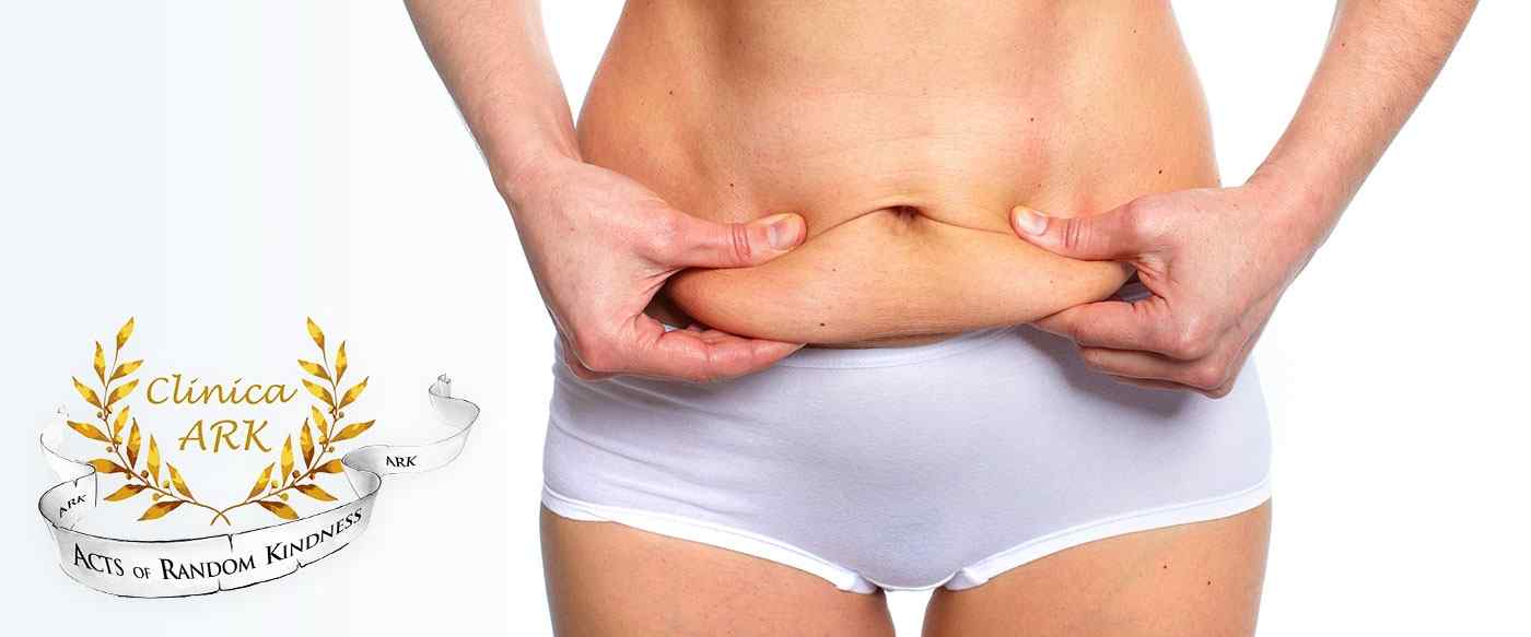 pierderea în greutate după abdominoplastie