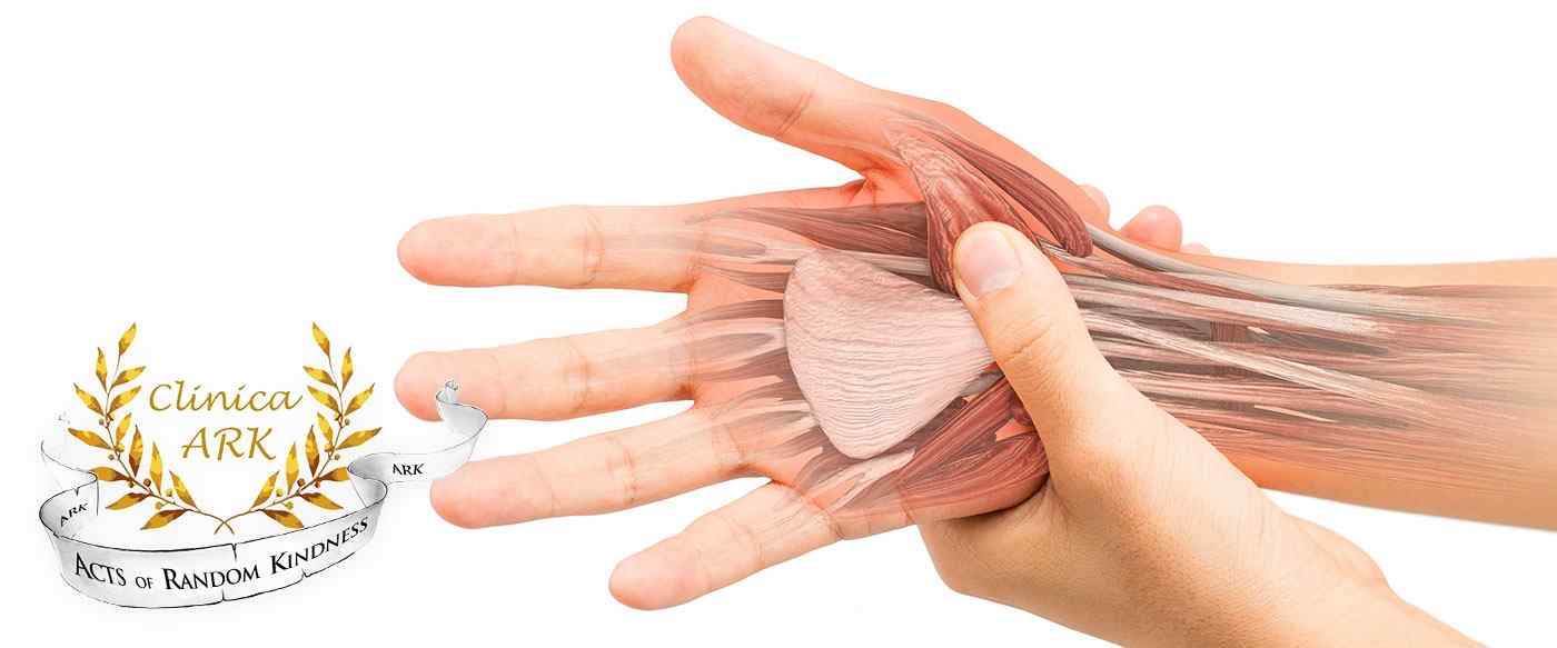 leziuni ale articulațiilor mâinilor